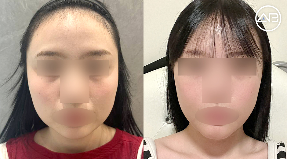 AB Plastic Surgery