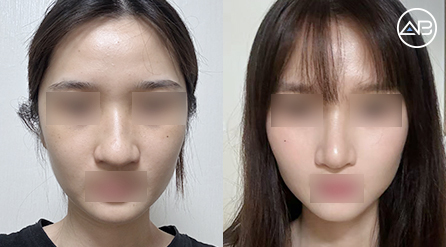 AB Plastic Surgery